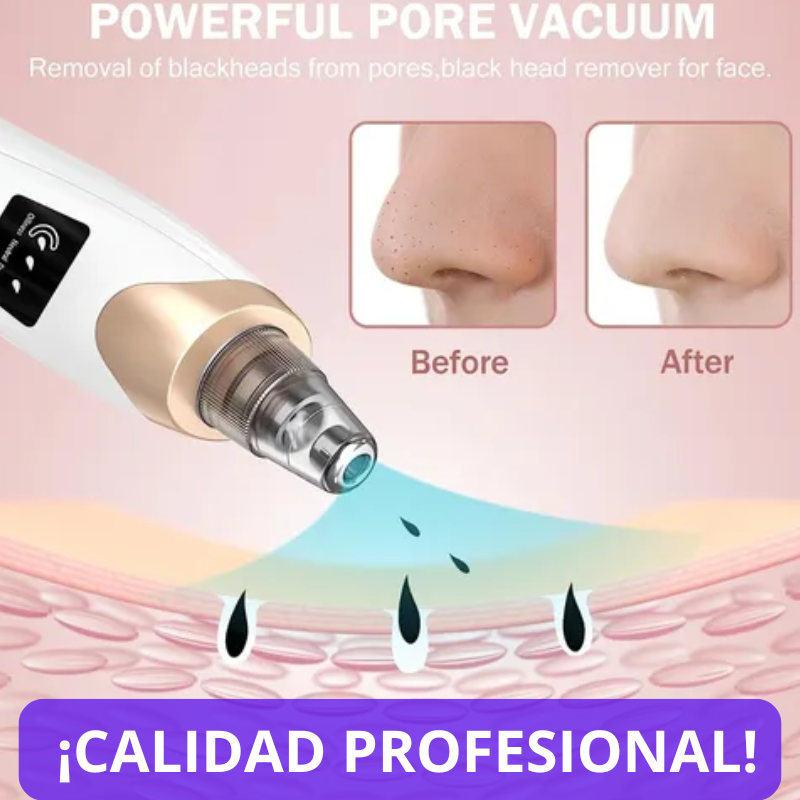 ASPIRADORA FACIAL SPA